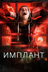  Имплант (2021) 